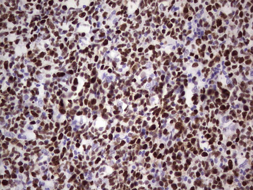 MCM2 Antibody - Immunohistochemical staining of paraffin-embedded Human tonsil within the normal limits using anti-MCM2 mouse monoclonal antibody. (Heat-induced epitope retrieval by 1 mM EDTA in 10mM Tris, pH8.5, 120C for 3min,