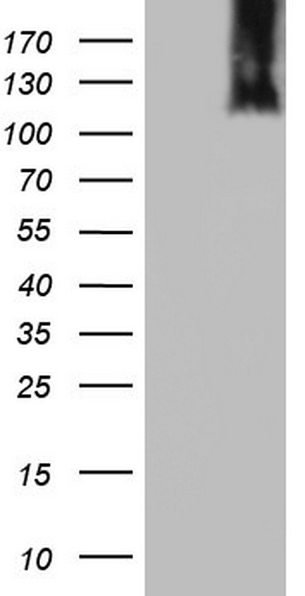 MCM2 Antibody - HEK293T cells were transfected with the pCMV6-ENTRY control (Left lane) or pCMV6-ENTRY MCM2 (Right lane) cDNA for 48 hrs and lysed. Equivalent amounts of cell lysates (5 ug per lane) were separated by SDS-PAGE and immunoblotted with anti-MCM2.