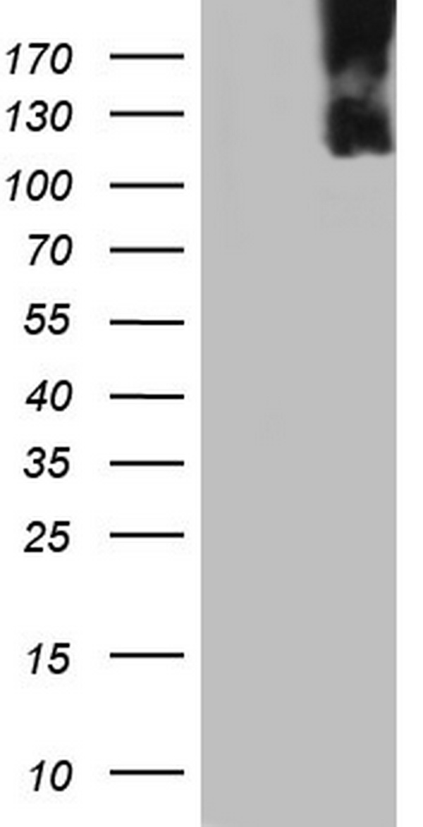 MCM2 Antibody - HEK293T cells were transfected with the pCMV6-ENTRY control. (Left lane) or pCMV6-ENTRY MCM2. (Right lane) cDNA for 48 hrs and lysed. Equivalent amounts of cell lysates. (5 ug per lane) were separated by SDS-PAGE and immunoblotted with anti-MCM2.