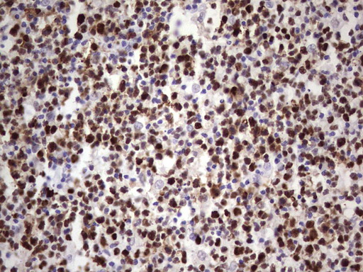 MCM2 Antibody - Immunohistochemical staining of paraffin-embedded Human tonsil within the normal limits using anti-MCM2 mouse monoclonal antibody. (Heat-induced epitope retrieval by 1 mM EDTA in 10mM Tris, pH8.5, 120C for 3min,