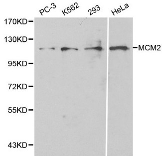 MCM2 Antibody - Western blot of MCM2 pAb in extracts from PC3, K562, 293 and Hela cells.