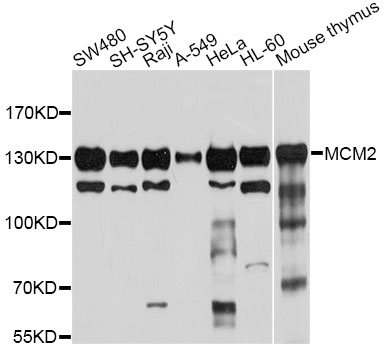MCM2 Antibody - Western blot analysis of extracts of various cell lines, using MCM2 antibody at 1:1000 dilution. The secondary antibody used was an HRP Goat Anti-Rabbit IgG (H+L) at 1:10000 dilution. Lysates were loaded 25ug per lane and 3% nonfat dry milk in TBST was used for blocking. An ECL Kit was used for detection and the exposure time was 10s.