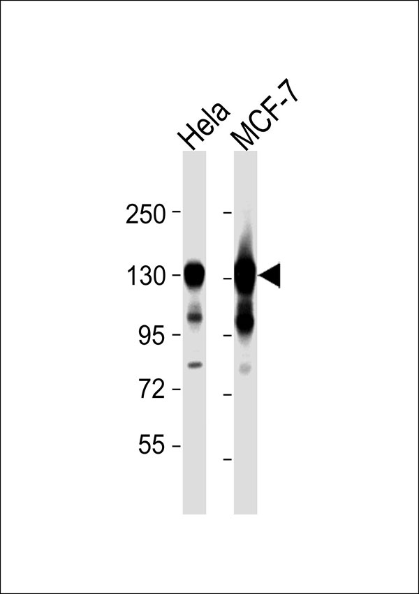 MCM2 Antibody - All lanes : Anti-MCM2 Antibody at 1:4000 dilution Lane 1: HeLa whole cell lysates Lane 2: MCF-7 whole cell lysates Lysates/proteins at 20 ug per lane. Secondary Goat Anti-Rabbit IgG, (H+L),Peroxidase conjugated at 1/10000 dilution Predicted band size : 102 kDa Blocking/Dilution buffer: 5% NFDM/TBST.