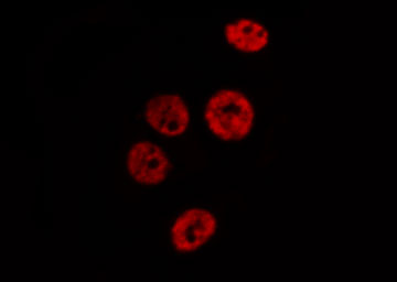 MCM2 Antibody - Staining HeLa cells by IF/ICC. The samples were fixed with PFA and permeabilized in 0.1% Triton X-100, then blocked in 10% serum for 45 min at 25°C. The primary antibody was diluted at 1:200 and incubated with the sample for 1 hour at 37°C. An Alexa Fluor 594 conjugated goat anti-rabbit IgG (H+L) antibody, diluted at 1/600, was used as secondary antibody.