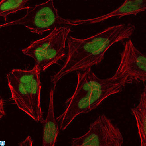 MCM2 Antibody - Immunofluorescence (IF) analysis of HeLa cells using BM28 Monoclonal Antibody (green). Blue: DRAQ5 fluorescent DNA dye. Red: Actin filaments have been labeled with Alexa Fluor-555 phalloidin.