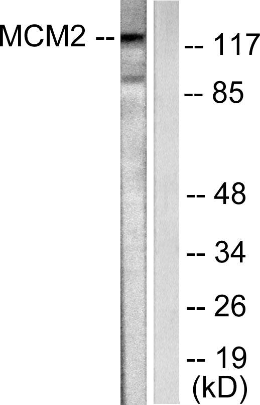 MCM2 Antibody - Western blot analysis of extracts from 293 cells, using MCM2 antibody.