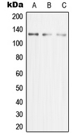 MCM2 Antibody - Western blot analysis of MCM2 expression in HeLa (A); Jurkat (B); HeLa (C) whole cell lysates.