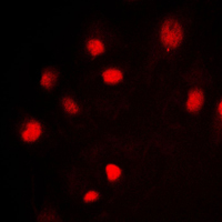 MCM2 Antibody - Immunofluorescent analysis of MCM2 staining in Jurkat cells. Formalin-fixed cells were permeabilized with 0.1% Triton X-100 in TBS for 5-10 minutes and blocked with 3% BSA-PBS for 30 minutes at room temperature. Cells were probed with the primary antibody in 3% BSA-PBS and incubated overnight at 4 C in a humidified chamber. Cells were washed with PBST and incubated with a DyLight 594-conjugated secondary antibody (red) in PBS at room temperature in the dark. DAPI was used to stain the cell nuclei (blue).