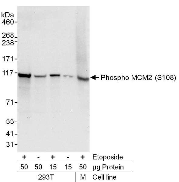 MCM2 Antibody - Detection of Human and Mouse Phospho MCM2 (S108) by Western Blot. Samples: Whole cell lysate (15 or 50 ug) from 293T cells or mouse NIH3T3 (M) cells. Cells were either mock treated (-) or treated (+) with etoposide (100 mu M, 2h). Antibodies: Affinity purified rabbit anti-phospho MCM2 (S108) antibody used for WB at 0.1 mcg/ml. Detection: Chemiluminescence with an exposure time of 10 seconds.