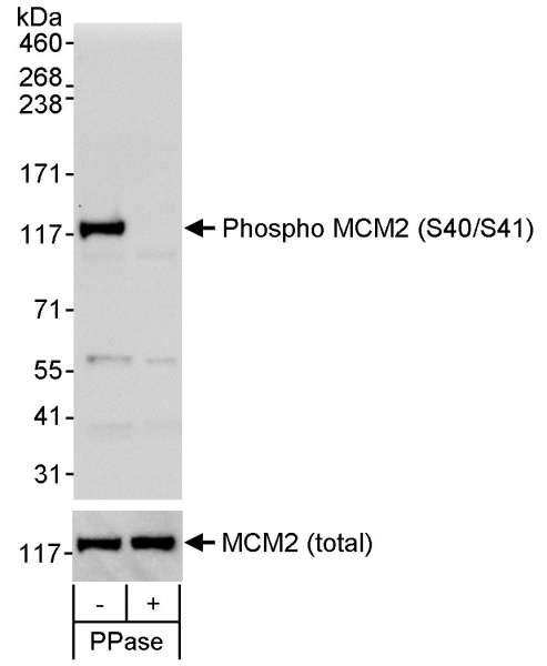 MCM2 Antibody - Detection of Human Phospho MCM2 (S40/S41) by Western Blot. Samples: Whole cell lysate (50 ug) from asynchronous 293T cells that was mock treated (-) or treated (+) with phosphatases (PPase). Antibody: Affinity purified rabbit anti-phospho MCM2 (S40/S41) antibody used at 0.1 ug/ml. To examine total MCM2, the blot was stripped and then blotted with rabbit anti-MCM2 antibody at 0.1 ug/ml. Detection: Chemiluminescence with exposure times of 30 seconds (upper and lower panels).