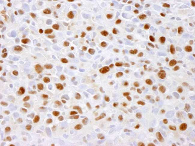 MCM2 Antibody - Detection of Mouse phospho-MCM2 (Ser 41) by Immunohistochemistry. Sample: FFPE section of mouse squamous cell carcinoma. Antibody: Affinity purified rabbit anti-Phospho-MCM2 (Ser 41) used at a dilution of 1:100. Detection: DAB.
