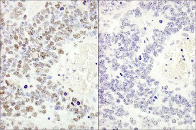MCM2 Antibody - Detection of Mouse Phospho-MCM2 (S53) by Immunohistochemistry. Samples: FFPE serial sections of mouse teratoma. Mock phosphatase treated section (left) or calf intestinal phosphatase treated section (right) immunostained for Phospho-MCM2 (S53). Antibody: Affinity purified rabbit anti-Phospho-MCM2 (S53) used at a dilution of 1:250. Epitope Retrieval Buffer-High pH (IHC-101J) was substituted for Epitope Retrieval Buffer-Reduced pH.