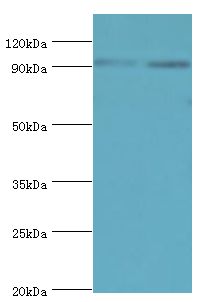 MCM3 Antibody - Western blot. All lanes: MCM3 antibody at 4 ug/ml. Lane 1: HeLa whole cell lysate. Lane 2: 293T whole cell lysate. Lane 3: K562 whole cell lysate. Lane 4: HepG2 whole cell lysate. Lane 5: Jurkat whole cell lysate. Lane 6: U917 whole cell lysate. Secondary antibody: Goat polyclonal to rabbit at 1:10000 dilution. Predicted band size: 91 kDa. Observed band size: 91 kDa.