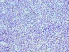 MCM3 Antibody - Immunohistochemistry of paraffin-embedded human tonsil using antibody at 1:100 dilution.