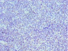 MCM3 Antibody - Immunohistochemistry of paraffin-embedded human tonsil tissue using MCM3 Antibody at dilution of 1:100