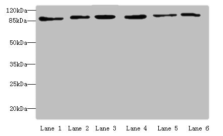 MCM3 Antibody - Western blot All lanes: MCM3 antibody at 4 µg/ml Lane 1: Hela whole cell lysate Lane 2: 293T whole cell lysate Lane 3: K562 whole cell lysate Lane 4: HepG2 whole cell lysate Lane 5: Jurkats whole cell lysate Lane 6: U917 whole cell lysate Secondary Goat polyclonal to rabbit IgG at 1/10000 dilution Predicted band size: 91, 96 kDa Observed band size: 91 kDa