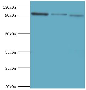 MCM3 Antibody - Western blot. All lanes: DNA replication licensing factor MCM3 antibody at 8 ug/ml. Lane 1: HeLa whole cell lysate. Lane 2: K562 whole cell lysate. Lane 3: 293T whole cell lysate. secondary Goat polyclonal to rabbit at 1:10000 dilution. Predicted band size: 91 kDa. Observed band size: 91 kDa.
