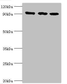MCM3 Antibody - Western blot All lanes: DNA replication licensing factor MCM3 antibody at 8µg/ml Lane 1: Hela whole cell lysate Lane 2: K562 whole cell lysate Lane 3: 293T whole cell lysate Secondary Goat polyclonal to rabbit IgG at 1/10000 dilution Predicted band size: 91, 96 kDa Observed band size: 91 kDa