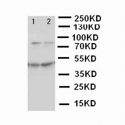 MCM3 Antibody - WB of MCM3 antibody. Lane 1: HELA Cell Lysate. Lane 2: JURKAT Cell lysate.