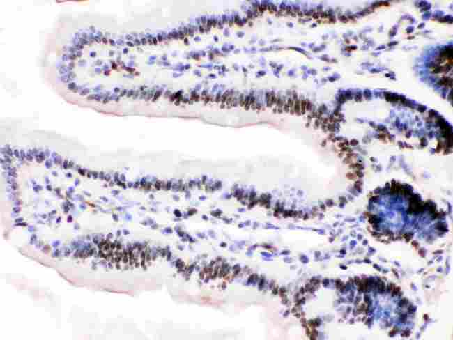 MCM3 Antibody - Anti-MCM3 antibody, IHC(P): Mouse Intestine Tissue