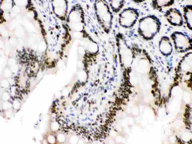 MCM3 Antibody - Anti-MCM3 antibody, IHC(P): Rat Intestine Tissue
