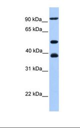 MCM3 Antibody - 721_B cell lysate. Antibody concentration: 1.0 ug/ml. Gel concentration: 12%.  This image was taken for the unconjugated form of this product. Other forms have not been tested.