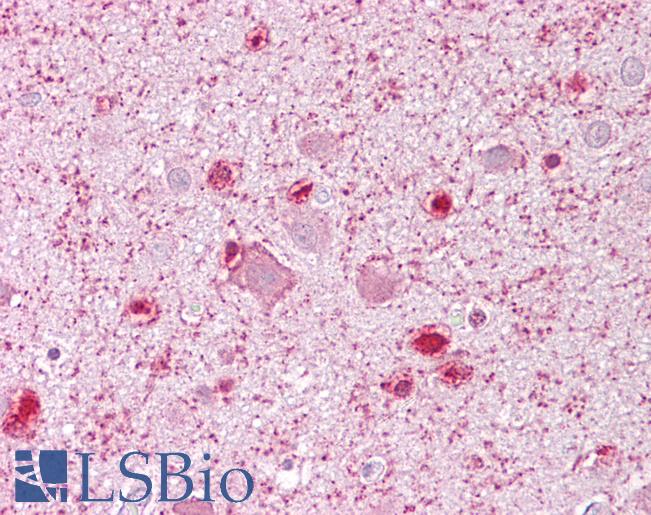 MCM3 Antibody - Anti-MCM3 antibody IHC of human brain, cortex. Immunohistochemistry of formalin-fixed, paraffin-embedded tissue after heat-induced antigen retrieval. Antibody concentration 5 ug/ml.  This image was taken for the unconjugated form of this product. Other forms have not been tested.