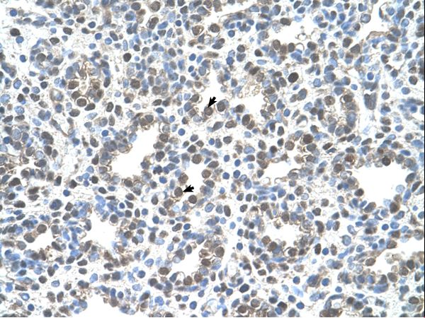 MCM3 Antibody - Human Lung.  This image was taken for the unconjugated form of this product. Other forms have not been tested.