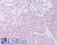 MCM3 Antibody - Anti-MCM3 antibody IHC of human thymus. Immunohistochemistry of formalin-fixed, paraffin-embedded tissue after heat-induced antigen retrieval. Antibody concentration 5 ug/ml.  This image was taken for the unconjugated form of this product. Other forms have not been tested.