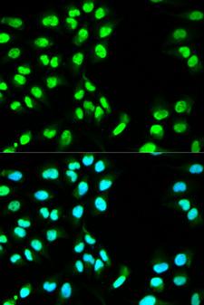 MCM3 Antibody - Immunofluorescence analysis of HeLa cells.