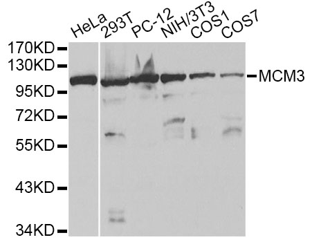 MCM3 Antibody - Western blot analysis of extracts of various cell lines, using MCM3 antibody at 1:1000 dilution. The secondary antibody used was an HRP Goat Anti-Rabbit IgG (H+L) at 1:10000 dilution. Lysates were loaded 25ug per lane and 3% nonfat dry milk in TBST was used for blocking.