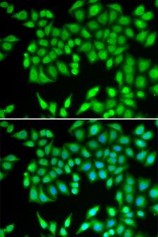MCM3 Antibody - Immunofluorescence analysis of U2OS cells using MCM3 antibody. Blue: DAPI for nuclear staining.