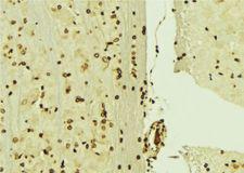 MCM3 Antibody - 1:100 staining mouse brain tissue by IHC-P. The sample was formaldehyde fixed and a heat mediated antigen retrieval step in citrate buffer was performed. The sample was then blocked and incubated with the antibody for 1.5 hours at 22°C. An HRP conjugated goat anti-rabbit antibody was used as the secondary.