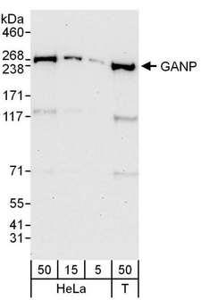 MCM3AP / GANP Antibody - Detection of Human GANP by Western Blot. Samples: Whole cell lysate from HeLa (5, 15 and 50 ug) and 293T (T; 50 ug) cells. Antibodies: Affinity purified rabbit anti-GANP antibody used for WB at 0.4 ug/ml. Detection: Chemiluminescence with an exposure time of 30 seconds.