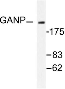 MCM3AP / GANP Antibody - Western blot of GANP/MCM3AP (E1872) pAb in extracts from NIH/3T3 cells.