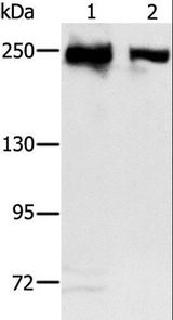 MCM3AP / GANP Antibody - Western blot analysis of HeLa and 293T cell, using MCM3AP Polyclonal Antibody at dilution of 1:350.
