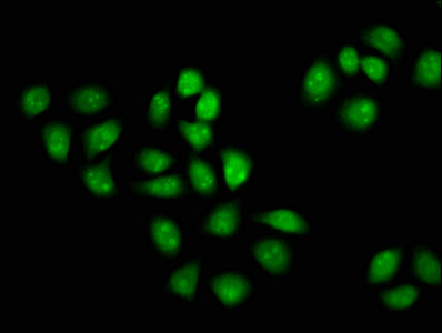 MCM3AP / GANP Antibody - Immunofluorescence staining of Hela cells with MCM3AP Antibody at 1:133, counter-stained with DAPI. The cells were fixed in 4% formaldehyde, permeabilized using 0.2% Triton X-100 and blocked in 10% normal Goat Serum. The cells were then incubated with the antibody overnight at 4°C. The secondary antibody was Alexa Fluor 488-congugated AffiniPure Goat Anti-Rabbit IgG(H+L).