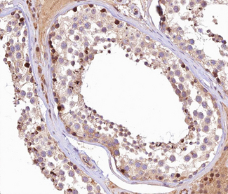 MCM3AP / GANP Antibody - 1:100 staining human Testis tissue by IHC-P. The tissue was formaldehyde fixed and a heat mediated antigen retrieval step in citrate buffer was performed. The tissue was then blocked and incubated with the antibody for 1.5 hours at 22°C. An HRP conjugated goat anti-rabbit antibody was used as the secondary.