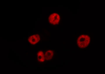 MCM3AP / GANP Antibody - Staining NIH-3T3 cells by IF/ICC. The samples were fixed with PFA and permeabilized in 0.1% Triton X-100, then blocked in 10% serum for 45 min at 25°C. The primary antibody was diluted at 1:200 and incubated with the sample for 1 hour at 37°C. An Alexa Fluor 594 conjugated goat anti-rabbit IgG (H+L) Ab, diluted at 1/600, was used as the secondary antibody.