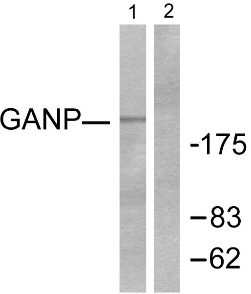 MCM3AP / GANP Antibody - Western blot analysis of extracts from NIH/3T3 cells, using GANP antibody.