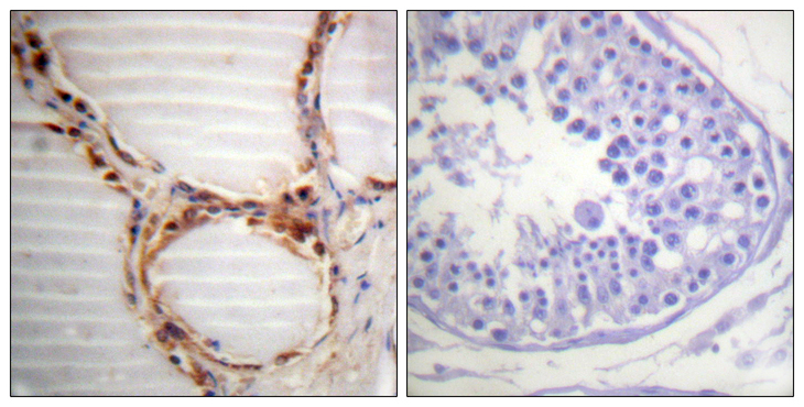 MCM4 Antibody - Immunohistochemistry analysis of paraffin-embedded human testis tissue, using MCM4 Antibody. The picture on the right is blocked with the synthesized peptide.