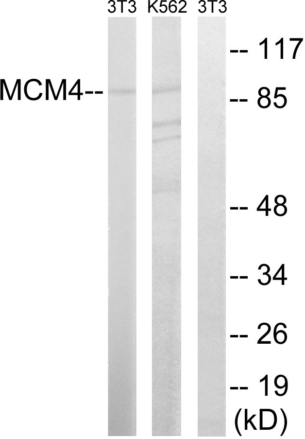 MCM4 Antibody - Western blot analysis of lysates from NIH/3T3 and K562 cells, using MCM4 Antibody. The lane on the right is blocked with the synthesized peptide.