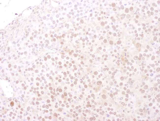 MCM4 Antibody - Detection of mouse MCM4 by immunohistochemistry. Sample: FFPE section of mouse renal cell carcinoma. Antibody: Affinity purified goat anti-MCM4 used at a dilution of 1:1,000 (1µg/ml). Detection: DAB
