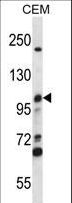 MCM4 Antibody - MCM4 Antibody western blot of CEM cell line lysates (35 ug/lane). The MCM4 antibody detected the MCM4 protein (arrow).