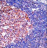 MCM4 Antibody - MCM4 Antibody immunohistochemistry of formalin-fixed and paraffin-embedded human tonsil tissue followed by peroxidase-conjugated secondary antibody and DAB staining.
