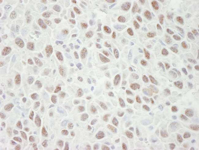 MCM4 Antibody - Detection of Mouse MCM4 by Immunohistochemistry. Sample: FFPE section of mouse squamous cell carcinoma. Antibody: Affinity purified rabbit anti-MCM4 used at a dilution of 1:250. Detection: DAB.