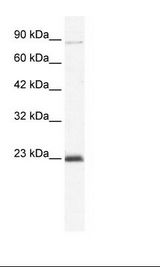 MCM4 Antibody - Jurkat Cell Lysate.  This image was taken for the unconjugated form of this product. Other forms have not been tested.