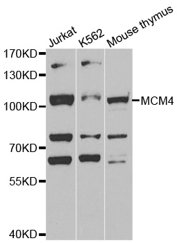 MCM4 Antibody - Western blot analysis of extracts of various cell lines.