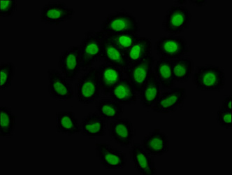 MCM4 Antibody - Immunofluorescence staining of A549 cells at a dilution of 1:133, counter-stained with DAPI. The cells were fixed in 4% formaldehyde, permeabilized using 0.2% Triton X-100 and blocked in 10% normal Goat Serum. The cells were then incubated with the antibody overnight at 4 °C.The secondary antibody was Alexa Fluor 488-congugated AffiniPure Goat Anti-Rabbit IgG (H+L) .