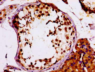 MCM4 Antibody - Immunohistochemistry image at a dilution of 1:100 and staining in paraffin-embedded human testis tissue performed on a Leica BondTM system. After dewaxing and hydration, antigen retrieval was mediated by high pressure in a citrate buffer (pH 6.0) . Section was blocked with 10% normal goat serum 30min at RT. Then primary antibody (1% BSA) was incubated at 4 °C overnight. The primary is detected by a biotinylated secondary antibody and visualized using an HRP conjugated SP system.